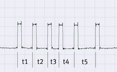 The PPM signal of a remote control with 5 channels